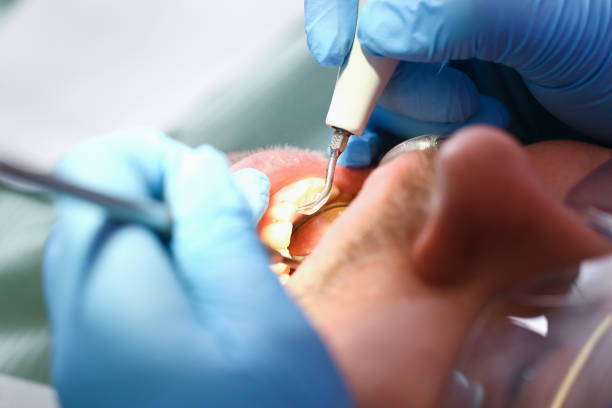 Best Emergency Dental Care for Broken or Chipped Teeth in Brockway, PA