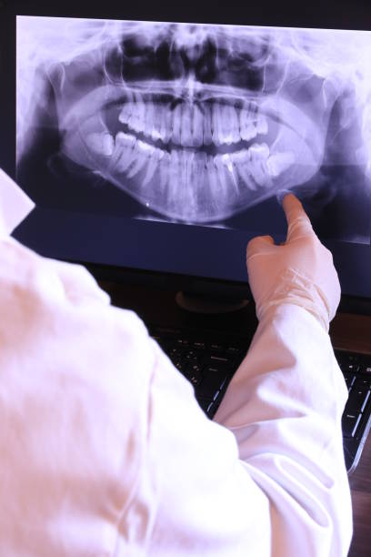 Best Emergency Tooth Extraction in Brockway, PA