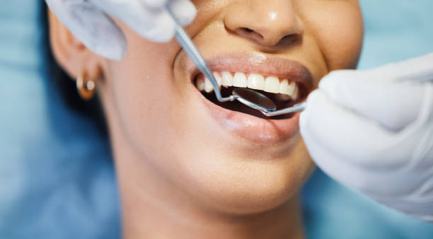 Best Urgent Care for Lost Fillings or Crowns in Brockway, PA